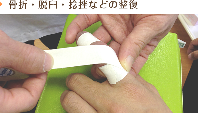 骨折・脱臼・捻挫などの整復